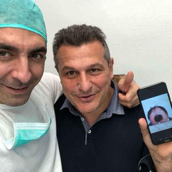 dott alex milosevic pallaoro 13 trapianto capelli