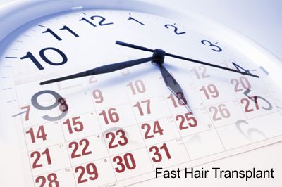 trapianto capelli fast