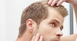 Calvizie maschile età: Perdere i capelli a 18 anni